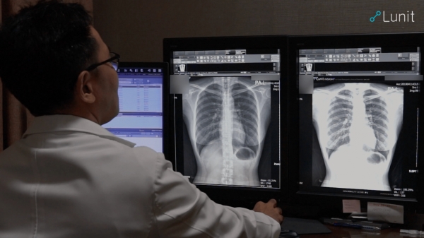 ‘루닛 인사이트 CXR’을 사용해 흉부 엑스레이를 분석하는 모습. [루닛 제공]