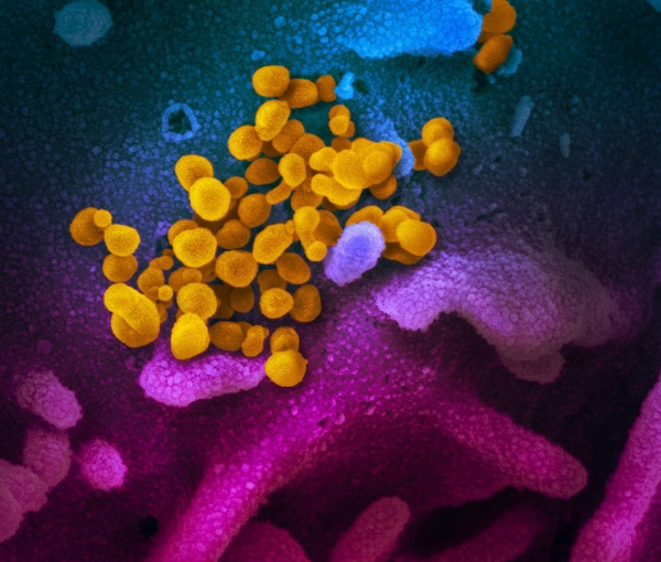 전자현미경으로 포착된 코로나19바이러스(노란색)가 보라색 세포표면에 달라붙어 있다. [사진=NIH]