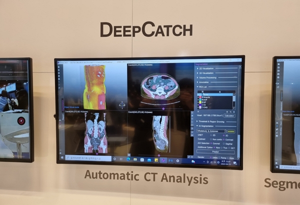 메디컬아이피의 AI 기반 세분화 솔루션 'DEEPCATCH'. [사진=녹색경제신문]