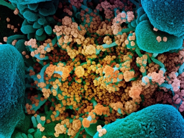 전자현미경으로 찍은 코로나19 바이러스.[사진=NIAID/NIH/SPL]